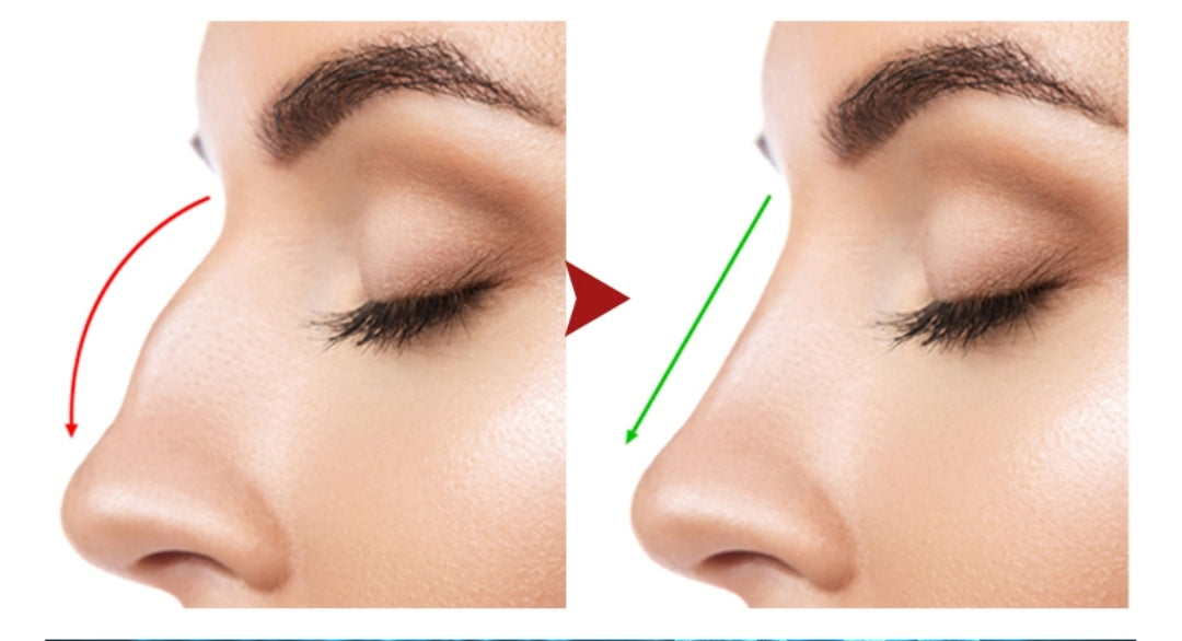 Ácido Hialurónico Reticulado DEEP-LIDO 2.2 ml.